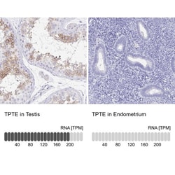 PTEN2/TPTE Antibody, Novus Biologicals:Antikörper:Primärantikörper